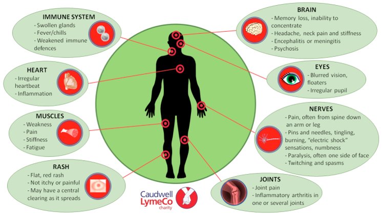 Lyme 150 symptoms and mimics other diseases